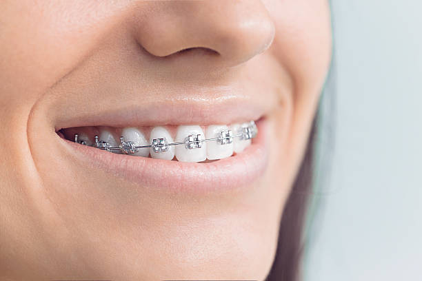 Best Invisalign and Clear Aligners  in East Chicago, IN